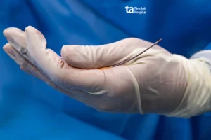 Stent phủ thuốc thế hệ mới nhất XIENCE SIERRA được sử dụng tại Bệnh viện Đa khoa Tâm Anh.