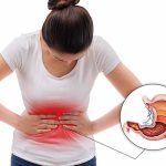 6 Loại Thuốc Chữa Trị Đau Dạ Dày Cho Hiệu Quả Nhanh