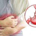 Thuốc Chữa Viêm Hang Vị Dạ Dày An Toàn Hiệu Quả Nhất