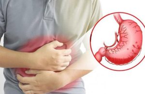 Thuốc Chữa Viêm Hang Vị Dạ Dày An Toàn Hiệu Quả Nhất