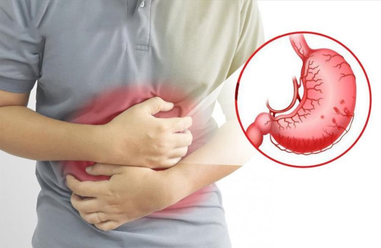 Nếu không được phát hiện, điều trị kịp thời, viêm hang vị dạ dày có thể phát triển thành ung thư
