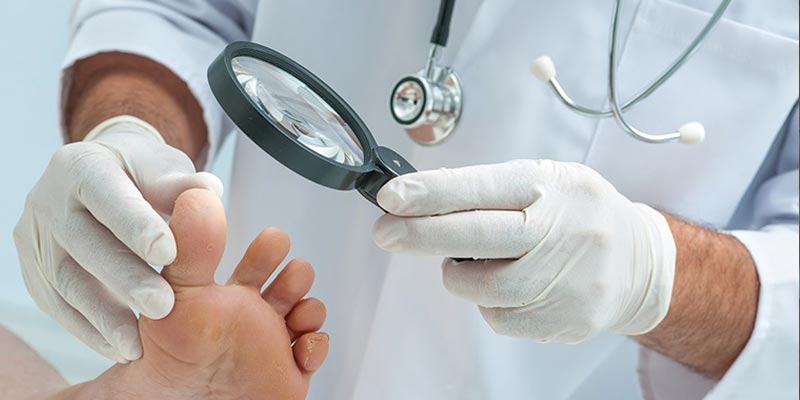Bệnh tổ đỉa có chữa khỏi hẳn được không? Chuyên gia nhận định như thế nào trước vấn đề này?