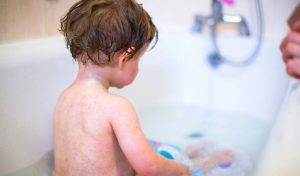 Tìm hiểu bị mề đay tắm lá gì để có kế hoạch chăm sóc và bảo vệ da phù hợp