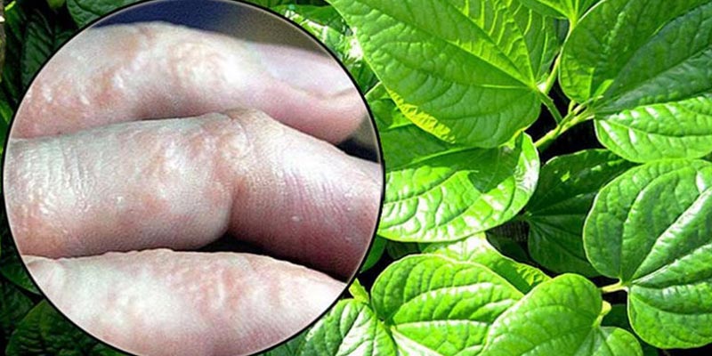 Công dụng của lá lốt trong điều trị bệnh tổ đỉa