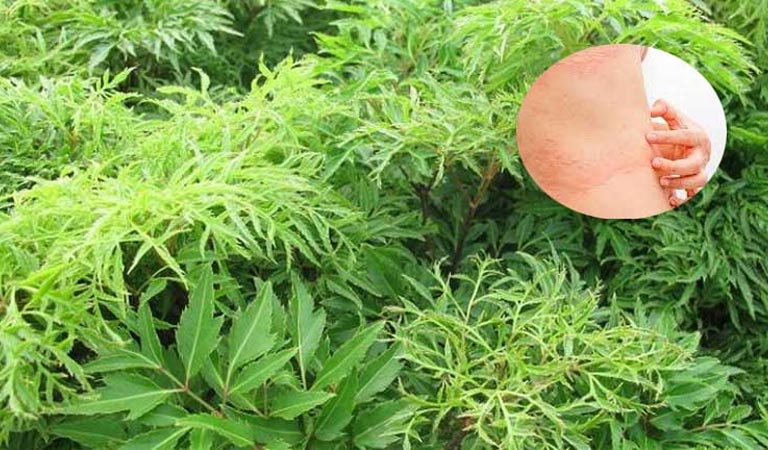 Lá đinh lăng với đặc tính kháng viêm, giải độc, thanh nhiệt tự nhiên đã trở thành phương thuốc chữa mề đay được nhiều người tin dùng