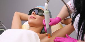 Điều trị viêm nang lông bằng laser là gì?