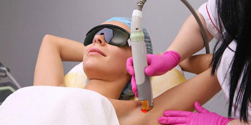 Điều trị viêm nang lông bằng laser là gì?