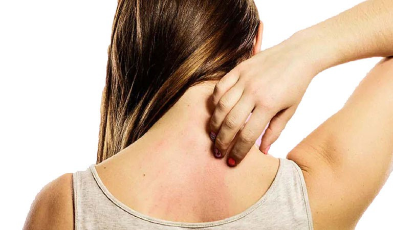 Triệu chứng của viêm da cơ địa là nổi mẩn đỏ, phát ban, viêm sưng và ngứa ngáy