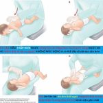 Hóc dị vật hoàn toàn có thể phòng tránh và xử trí hiệu quả nếu người chăm sóc trẻ nhận biết đúng dấu hiệu, thực hiện sơ cứu cũng như đưa đến cơ sở y tế kịp thời.