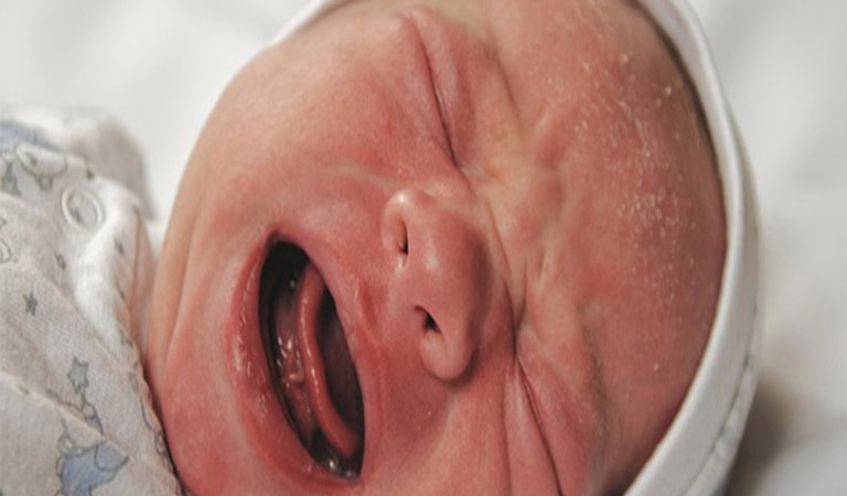 Viêm da tiết bã nhờn khiến da bé nổi mẩn đỏ