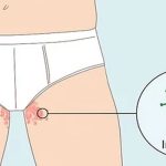 Viêm da tiếp xúc ở vùng kín có dấu hiệu gì?