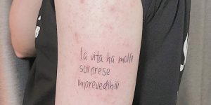 Viêm nang lông là gì?